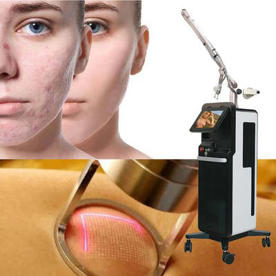 Macchine per la rimozione delle smagliature