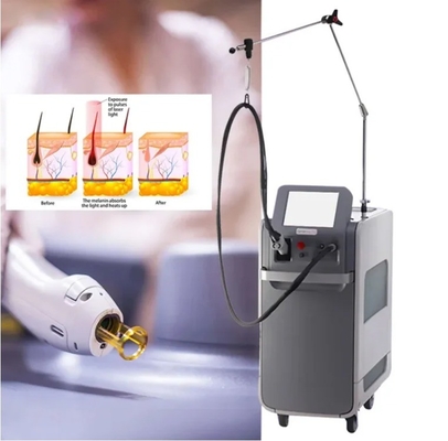 Eliminazione dei capelli a lunga durata Weifang KM 755nm Alexandrite 1064nm ND YAG Laser a lungo impulso