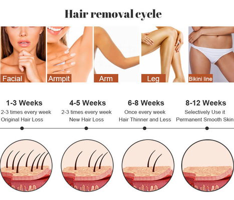 Salone di bellezza IPL Laser Machine Rimozione dei capelli RF cura della pelle Rimozione del tatuaggio