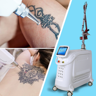 OEM ODM Macchina di rimozione del tatuaggio laser a picosecondi personalizzata con schermo touch colorato da 15 pollici