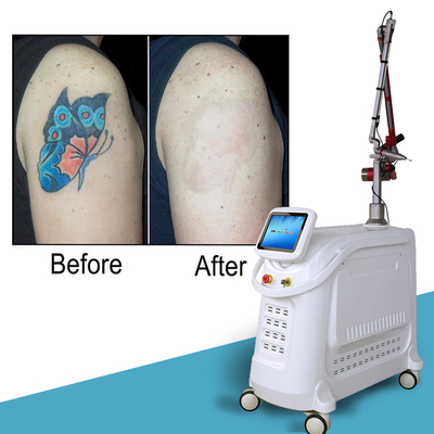 4 lunghezze d'onda Nd YAG Q Switch Laser Machine Rimozione del tatuaggio Stile stazionario