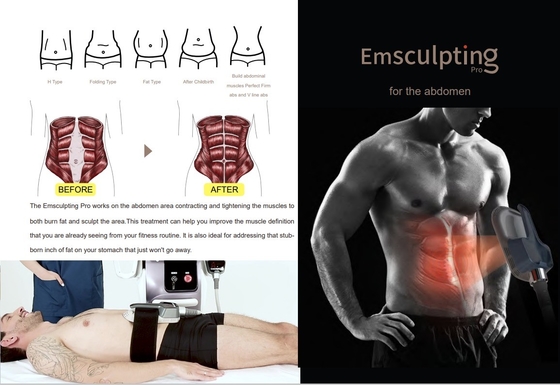 Macchina avanzata di dimagrimento EMS 150HZ Frequenza per la riduzione della cellulite