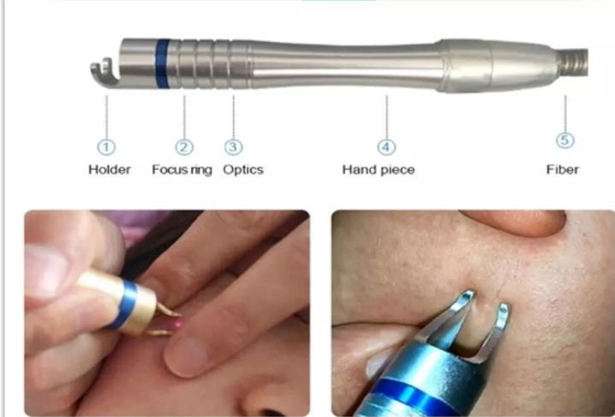 Ringiovanimento della pelle 980nm Diode Laser Machine Portatile Laser Spider Vein Removal Machine