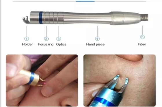 15W 30W Laser Vascular Removal Machine per il trattamento delle unghie / Ringiovanimento della pelle con laser caldo