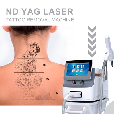 Macchina per la depilazione laser a lungo impulso Nd YAG Portatile per uso commerciale