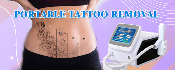 Equipaggiamento per la rimozione dei tatuaggi laser 1064nm 532nm