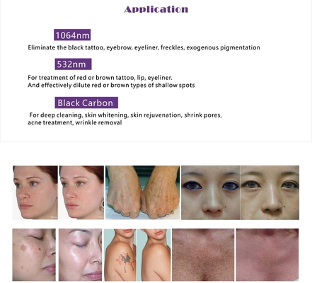 Multifunzione OPT IPL RF ND YAG Laser Machine depilazione con 15 pollici touch screen