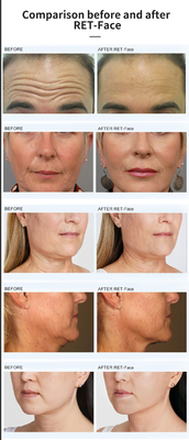 Vertical Magnetic Facial Ems rf Ringiovanimento della pelle Lifting Skin Tightening slimming Rf Lifting Machine machifor sal
